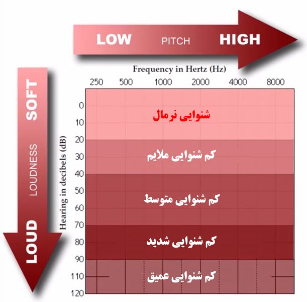 تفسیر نوار گوش